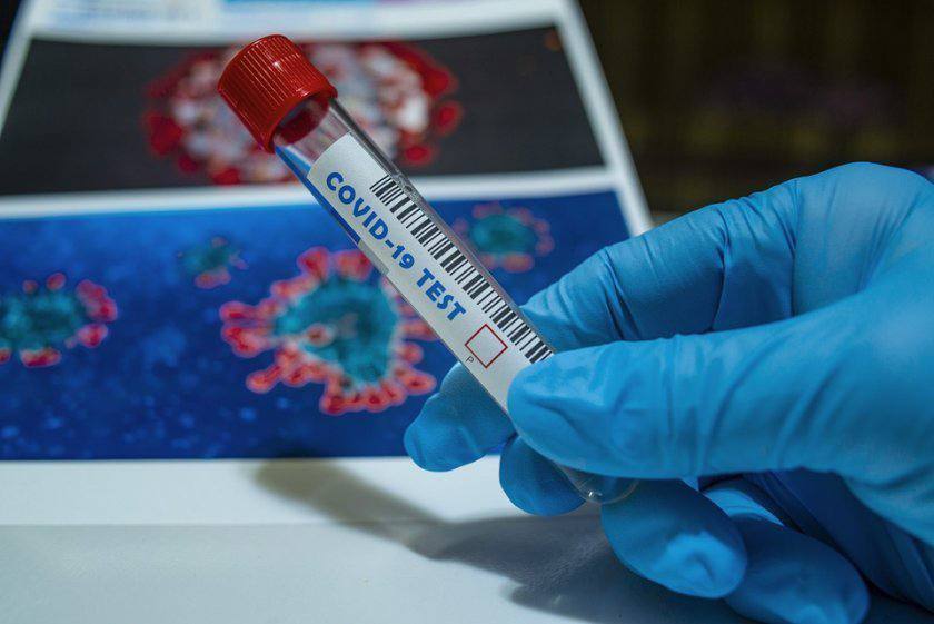 25 мая в Армавире новых случаев заражения коронавирусом не зарегистрировано