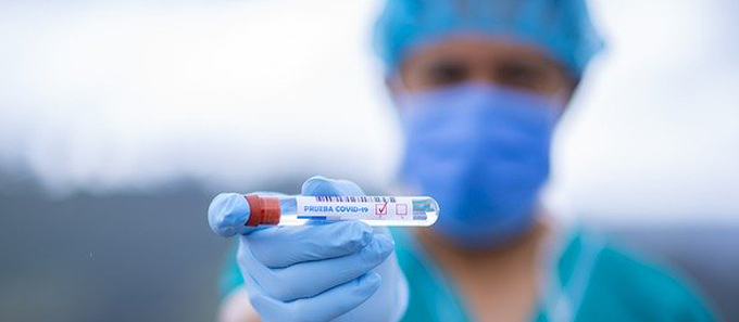 За минувшие сутки на Кубани коронавирус подтвердился у 57 человек