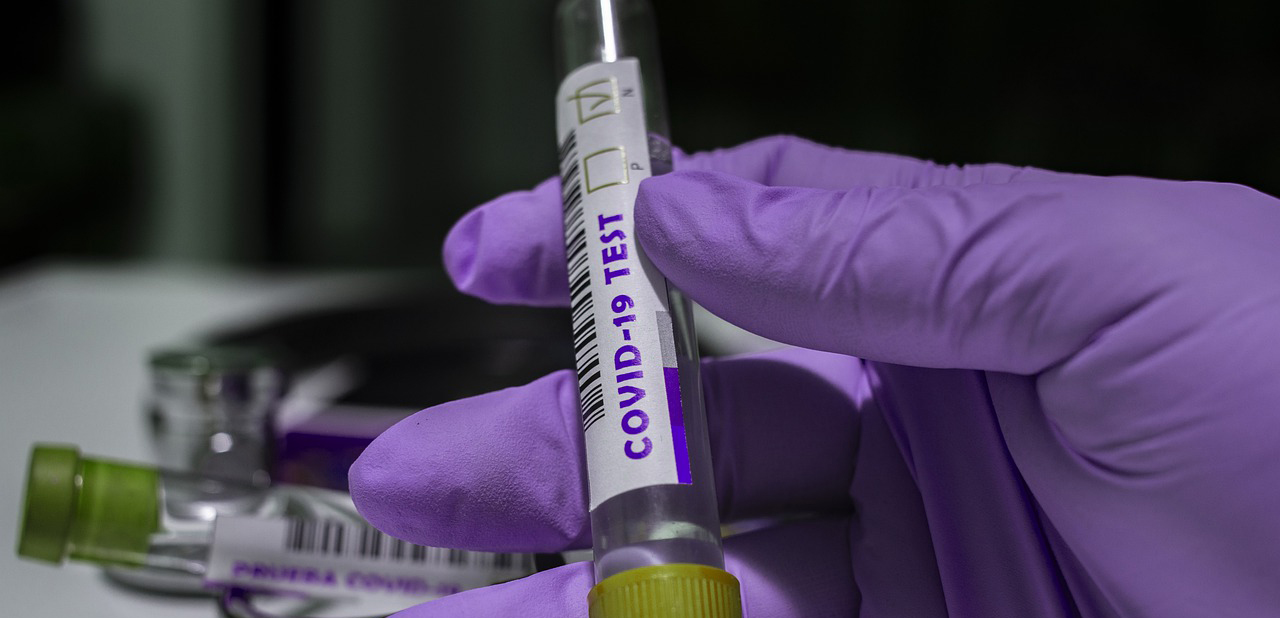 За минувшие сутки в Армавире новых случаев заражения коронавирусом не  подтвердилось