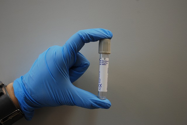 В Армавире за сутки выявили еще три случая заражения коронавирусом