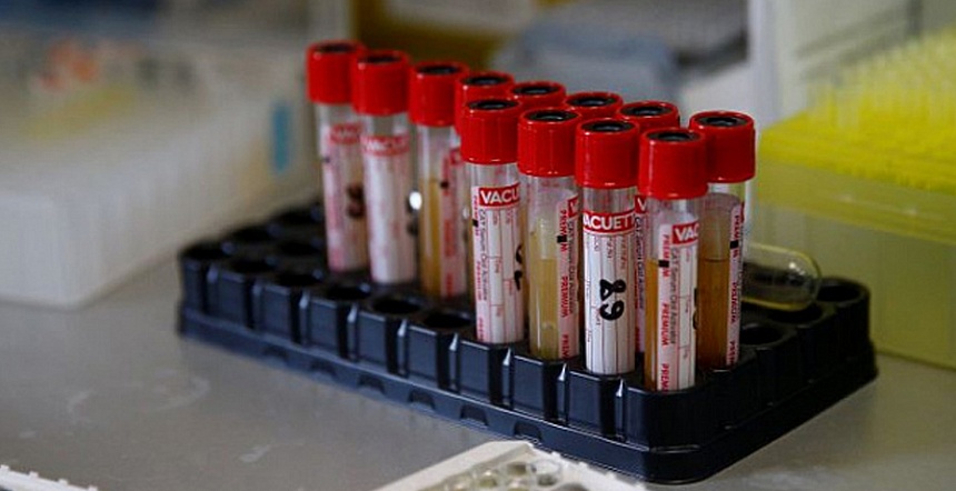 48 новых случаев заражения коронавирусом выявили на Кубани за минувшие сутки